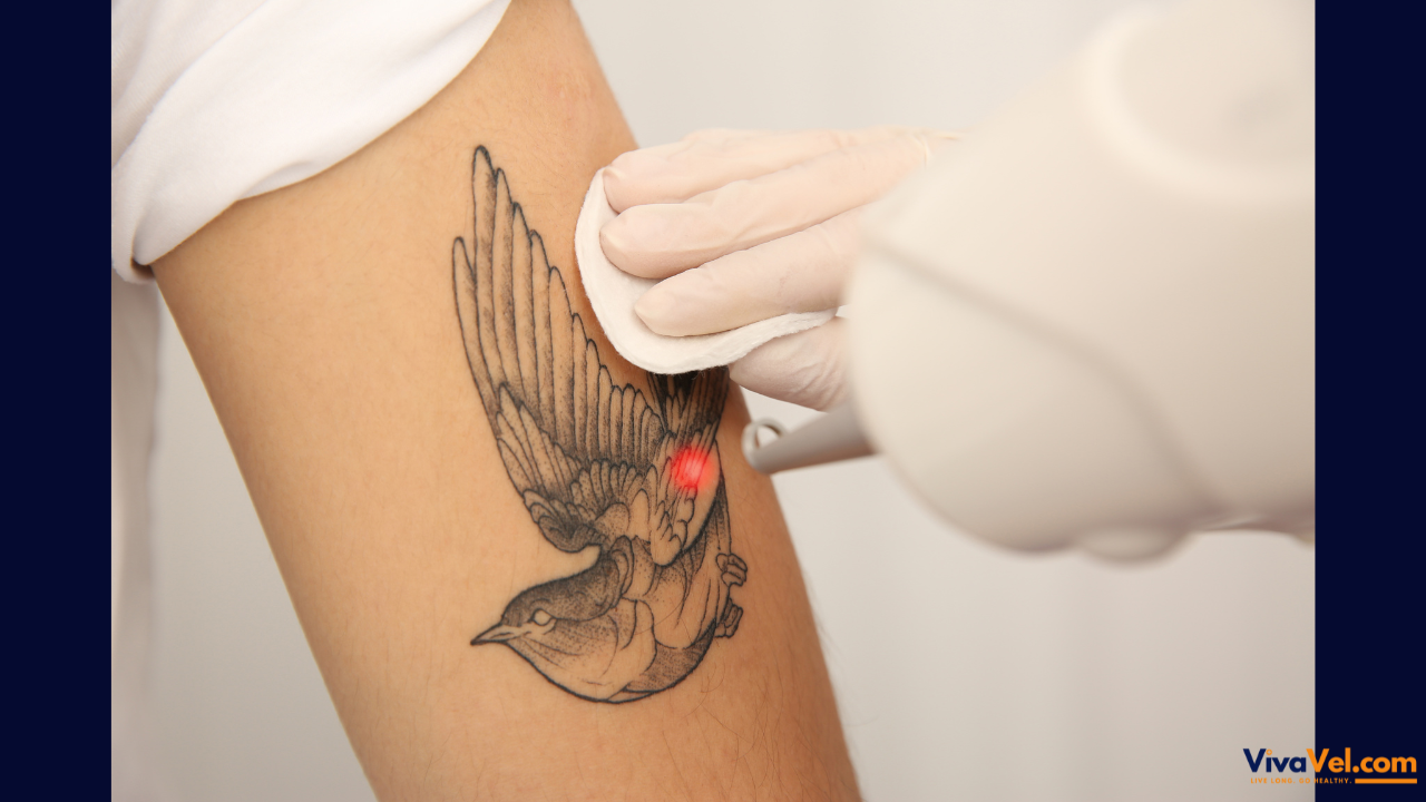 Laser Tattoo Removal in India | VivaVel Health