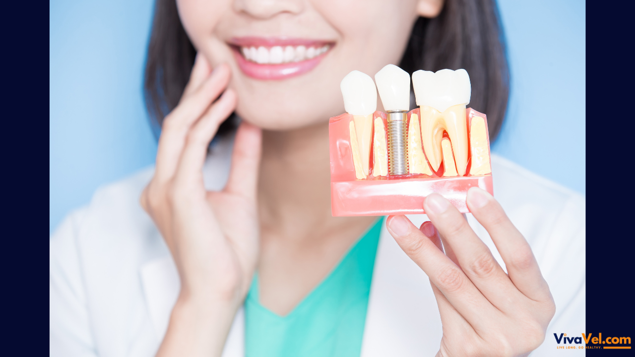 Dental Implant Treatment | Affordable Tooth Replacement Abroad | VivaVel Health | India