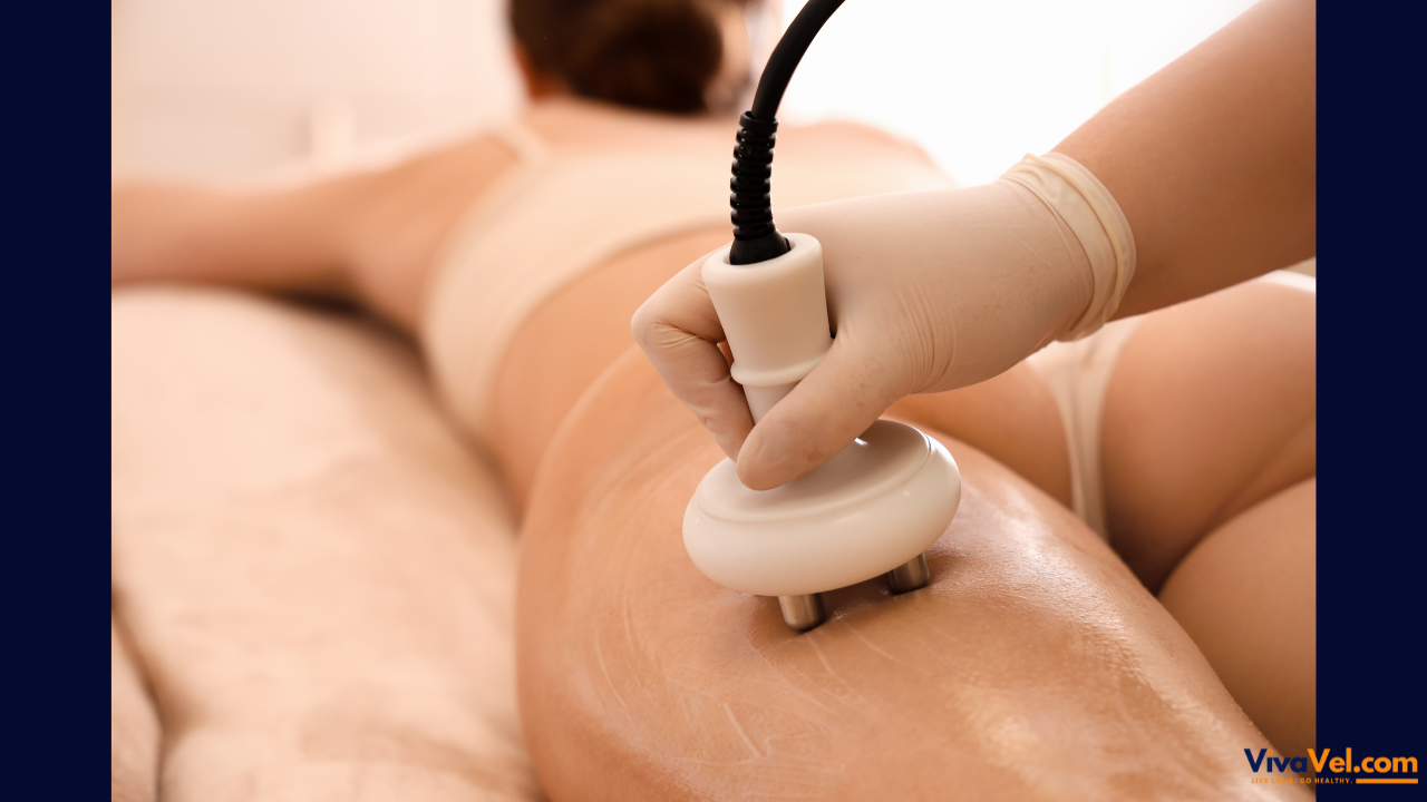 Cellulite Reduction Treatment | Non-Surgical Body Contouring Abroad | VivaVel Health | India