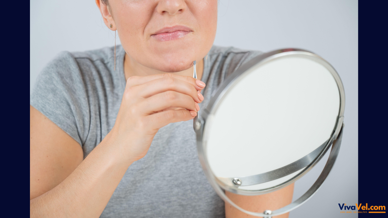 Hirsutism Treatment Abroad | PCOS Hair Removal & Hormone Therapy | VivaVel Health | India