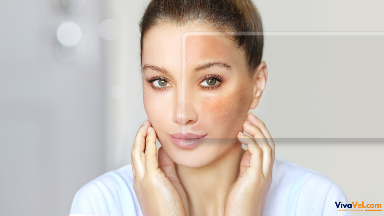 Milia Removal Treatment Abroad | Laser & Extraction for Smooth Skin | VivaVel Health | India