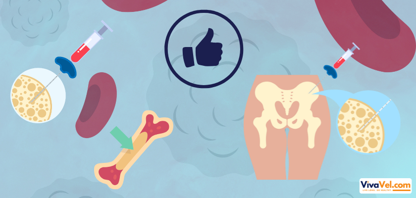 What is the Success Rate of Bone Marrow Transplant?