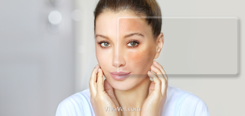 Dry Skin in Winter: Causes, Risk Factors, Prevention & When to Seek Help