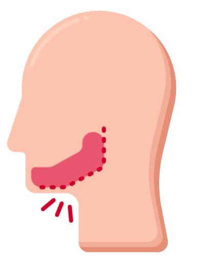 Maxillofacial surgery in India with expert facial surgeons