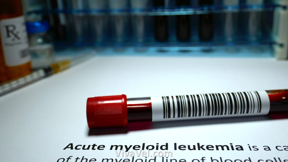 Acute myeloid leukemia (AML) Treatment