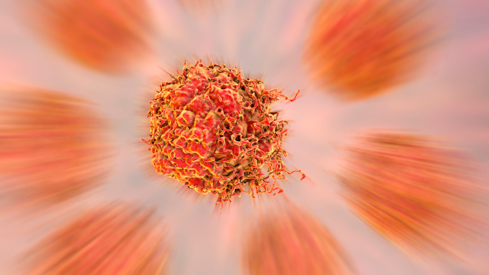 Metastatic cancer treatment options – VivaVel Health | India
