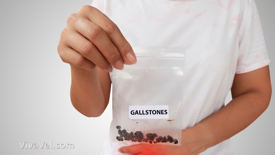 Bladder stone removal treatment – VivaVel Health