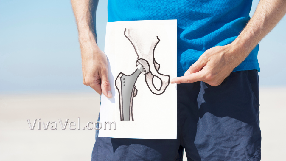 Bilateral hip replacement surgery – VivaVel Health