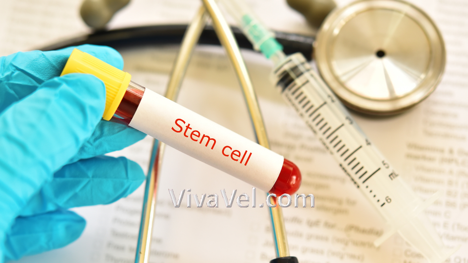 Stem cell transplant treatment – VivaVel Health
