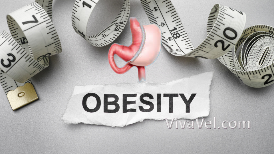 Sleeve Gastrectomy in India – Advanced Weight Loss Surgery | VivaVel Health