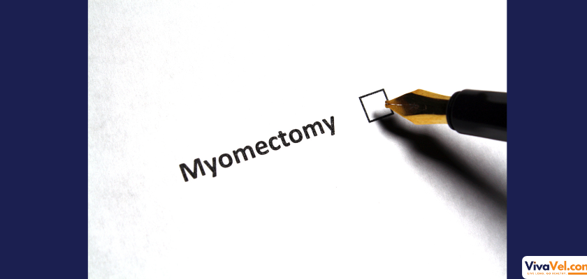 Laparoscopic Myomectomy with VivaVel Health – Advanced Fibroid Surgery in India