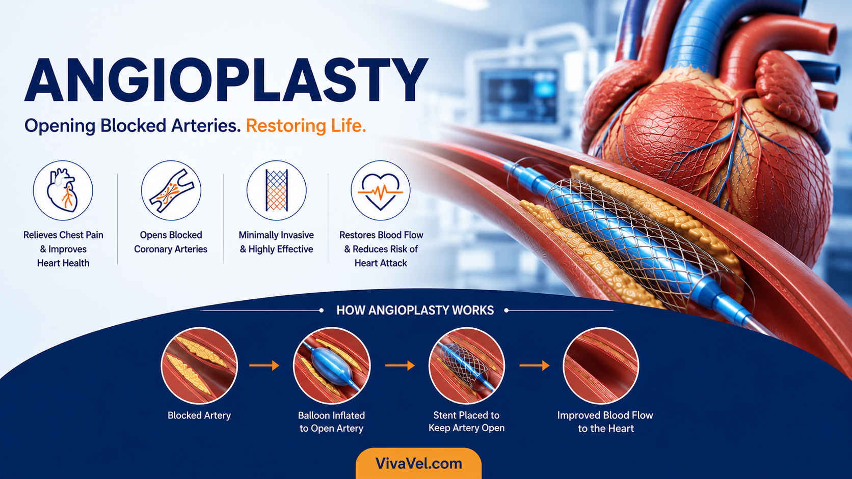 Angioplasty procedure showing stent placement to open blocked coronary arteries and restore blood flow to the heart